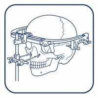 Craniofacial